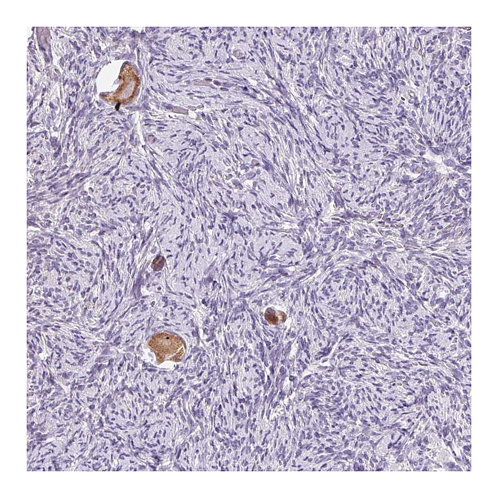 Atlas Antibodies Anti-SNX31 Antibody