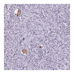 Atlas Antibodies Anti-SNX31 Antibody