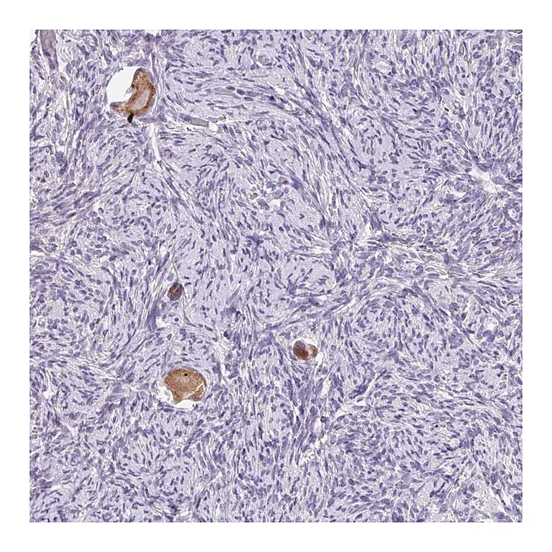 Atlas Antibodies Anti-SNX31 Antibody