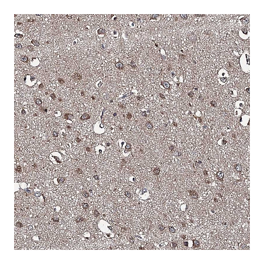 Atlas Antibodies Anti-SNX32 Antibody