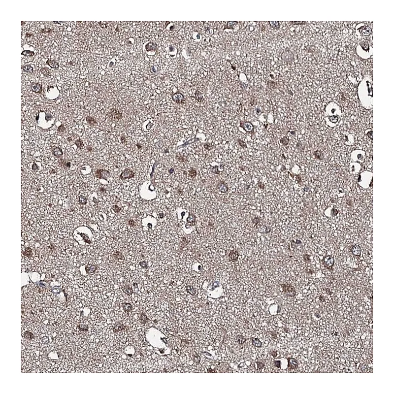 Atlas Antibodies Anti-SNX32 Antibody