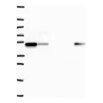 Atlas Antibodies Anti-SNX5 Antibody