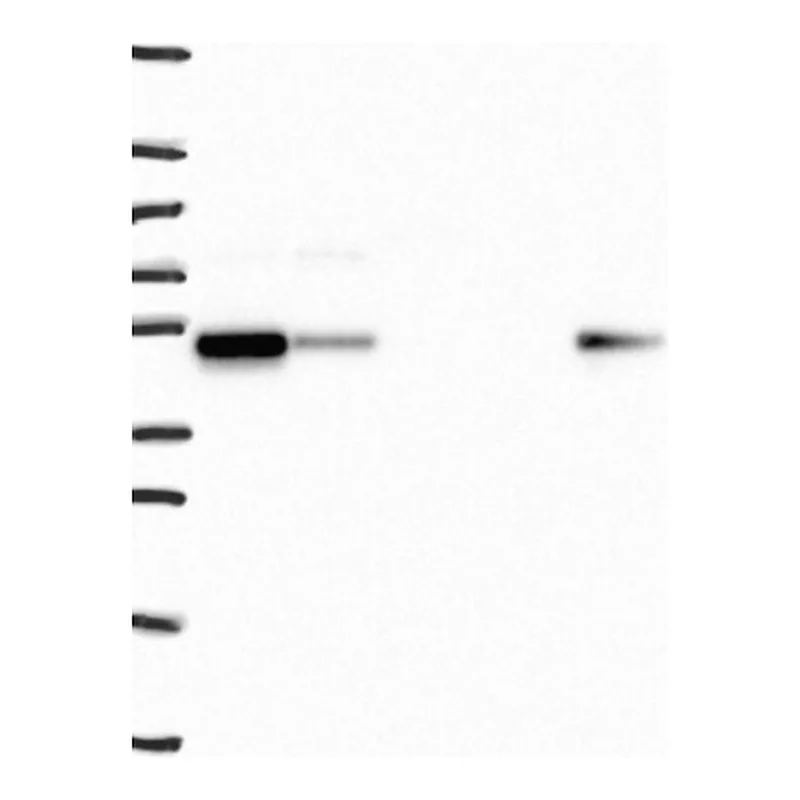 Atlas Antibodies Anti-SNX5 Antibody