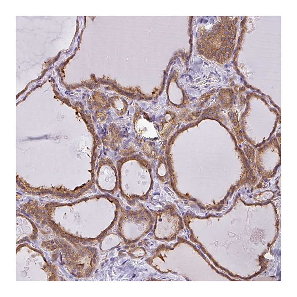 Atlas Antibodies Anti-SNX5 Antibody