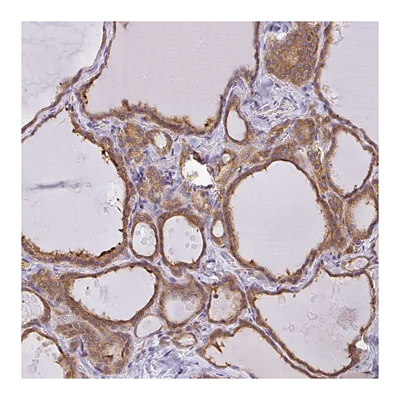 Atlas Antibodies Anti-SNX5 Antibody