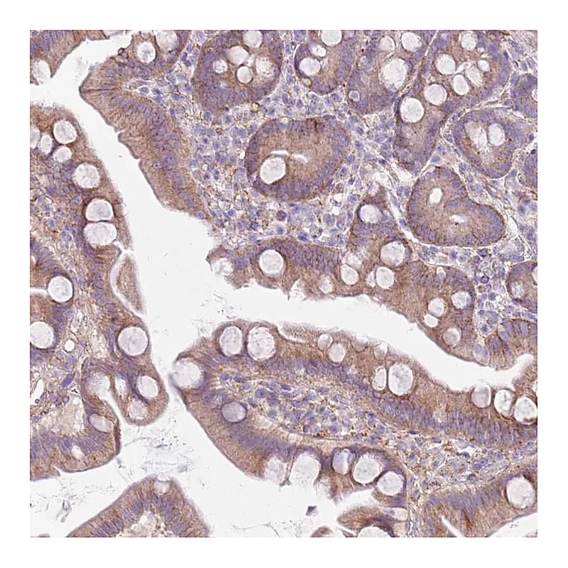 Atlas Antibodies Anti-SNX6 Antibody