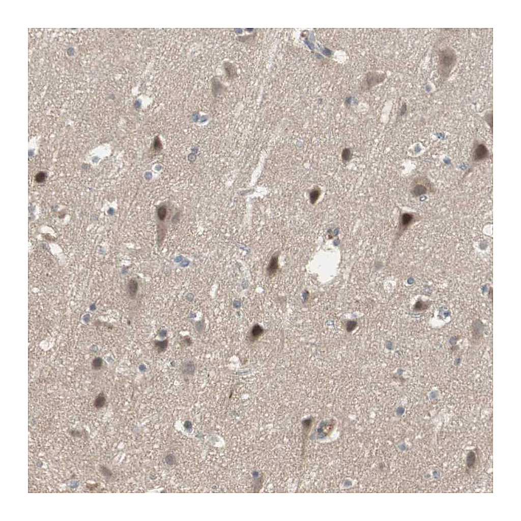 Atlas Antibodies Anti-SNX4 Antibody