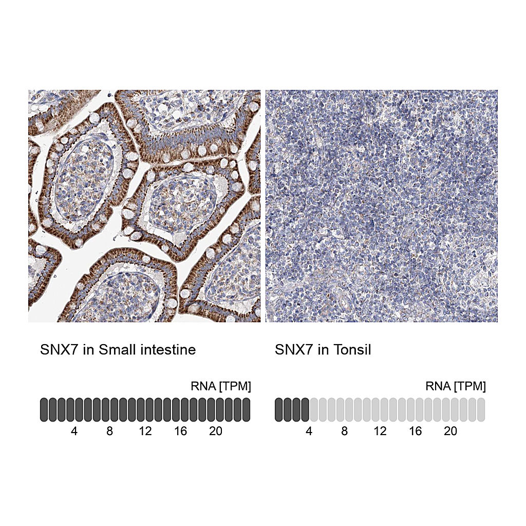 Atlas Antibodies Anti-SNX7 Antibody