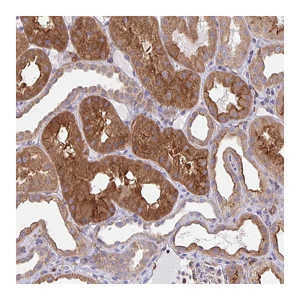 Atlas Antibodies Anti-SNX8 Antibody