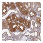 Atlas Antibodies Anti-SNX8 Antibody