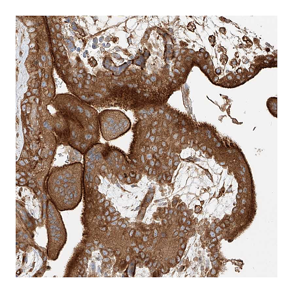 Atlas Antibodies Anti-SNX9 Antibody
