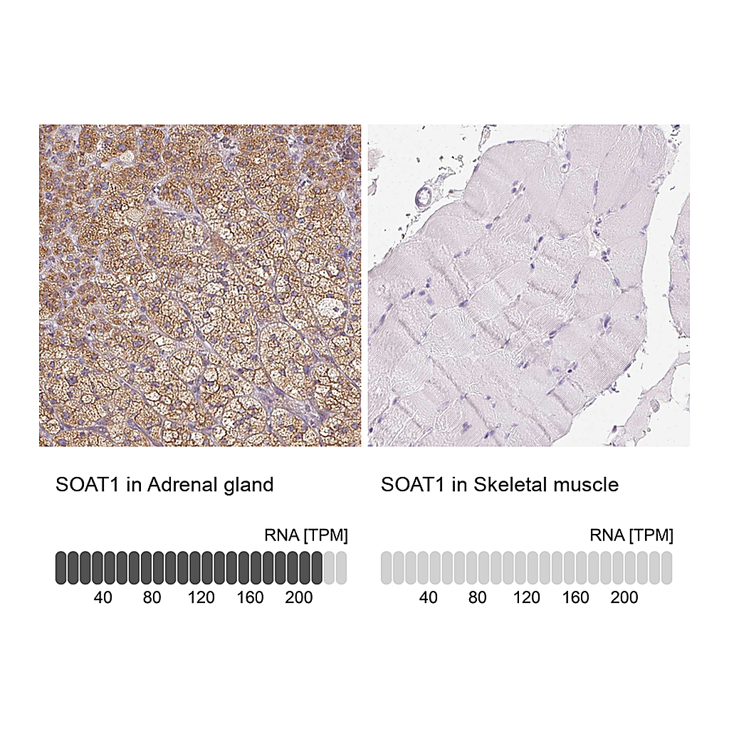 Atlas Antibodies Anti-SOAT1 Antibody