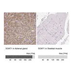 Atlas Antibodies Anti-SOAT1 Antibody