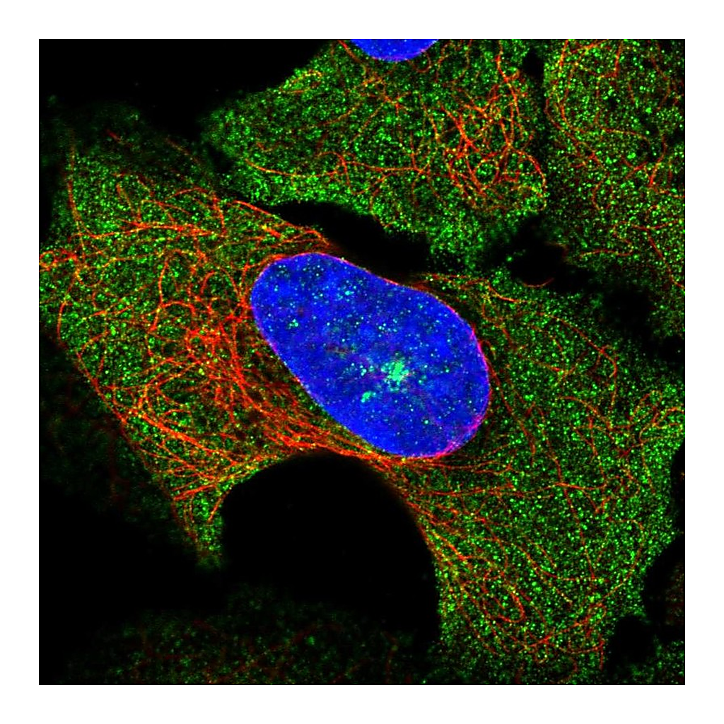 Atlas Antibodies Anti-SOCS3 Antibody