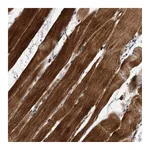 Atlas Antibodies Anti-SOBP Antibody