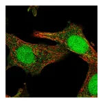 Atlas Antibodies Anti-SOCS4 Antibody