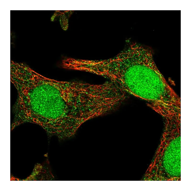 Atlas Antibodies Anti-SOCS4 Antibody