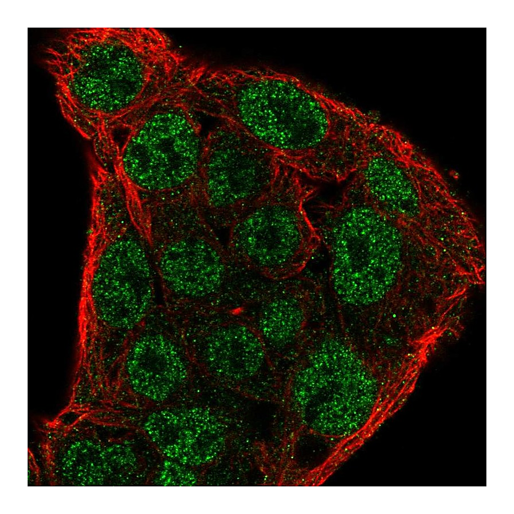 Atlas Antibodies Anti-SOCS1 Antibody