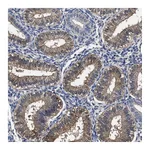 Atlas Antibodies Anti-SOCS5 Antibody