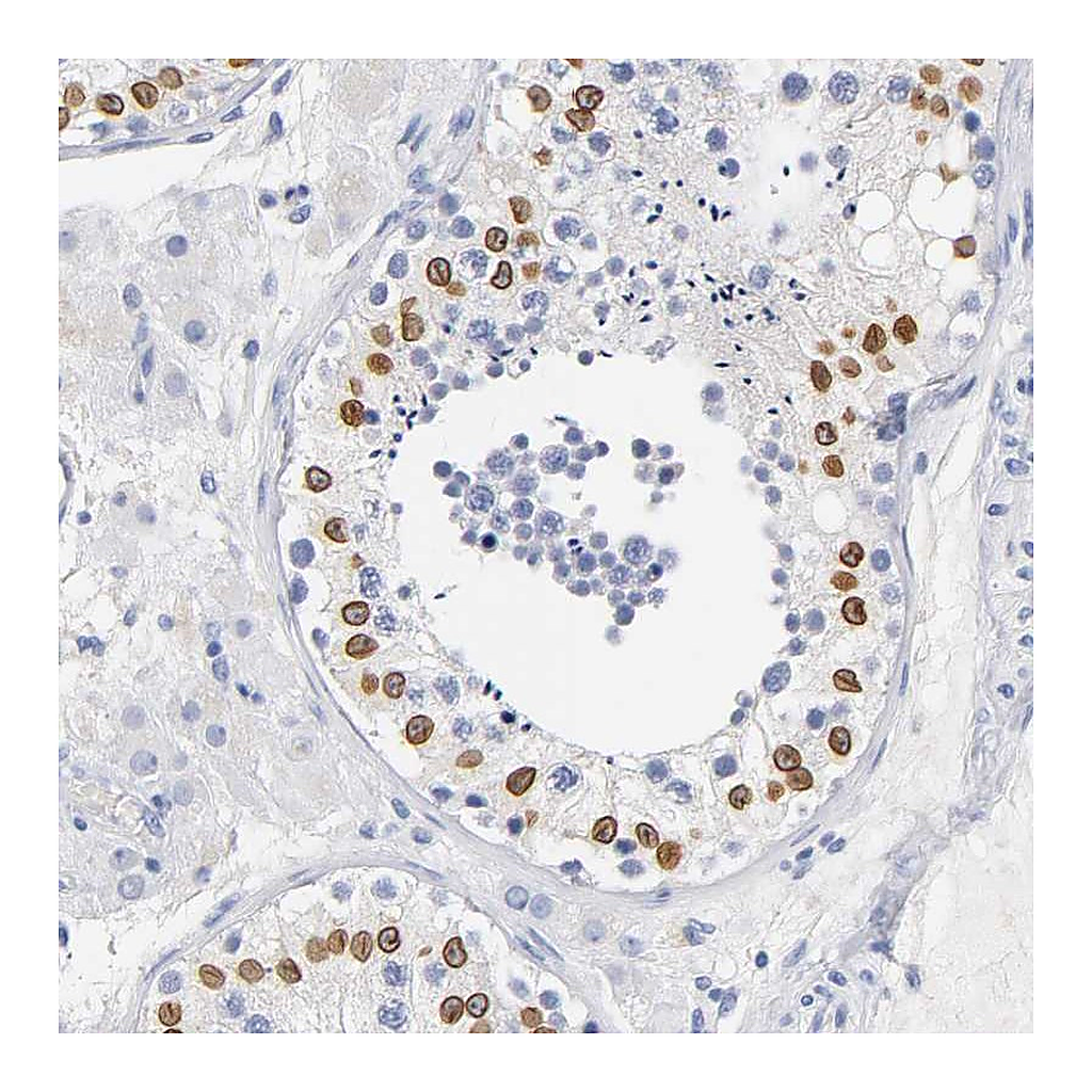 Atlas Antibodies Anti-SOCS7 Antibody