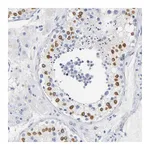 Atlas Antibodies Anti-SOCS7 Antibody