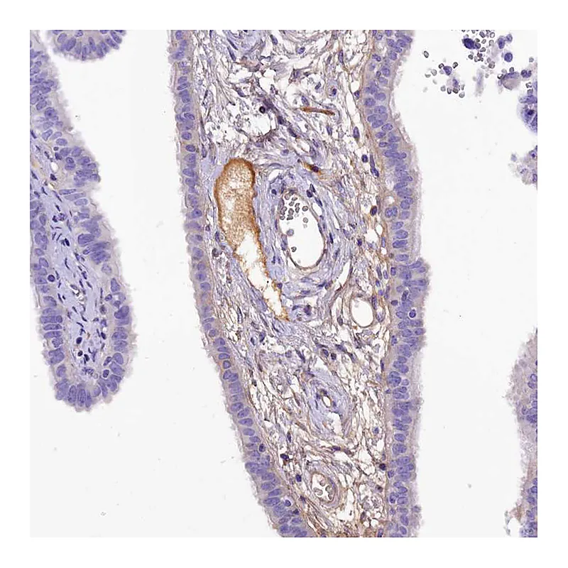 Atlas Antibodies Anti-SOD3 Antibody