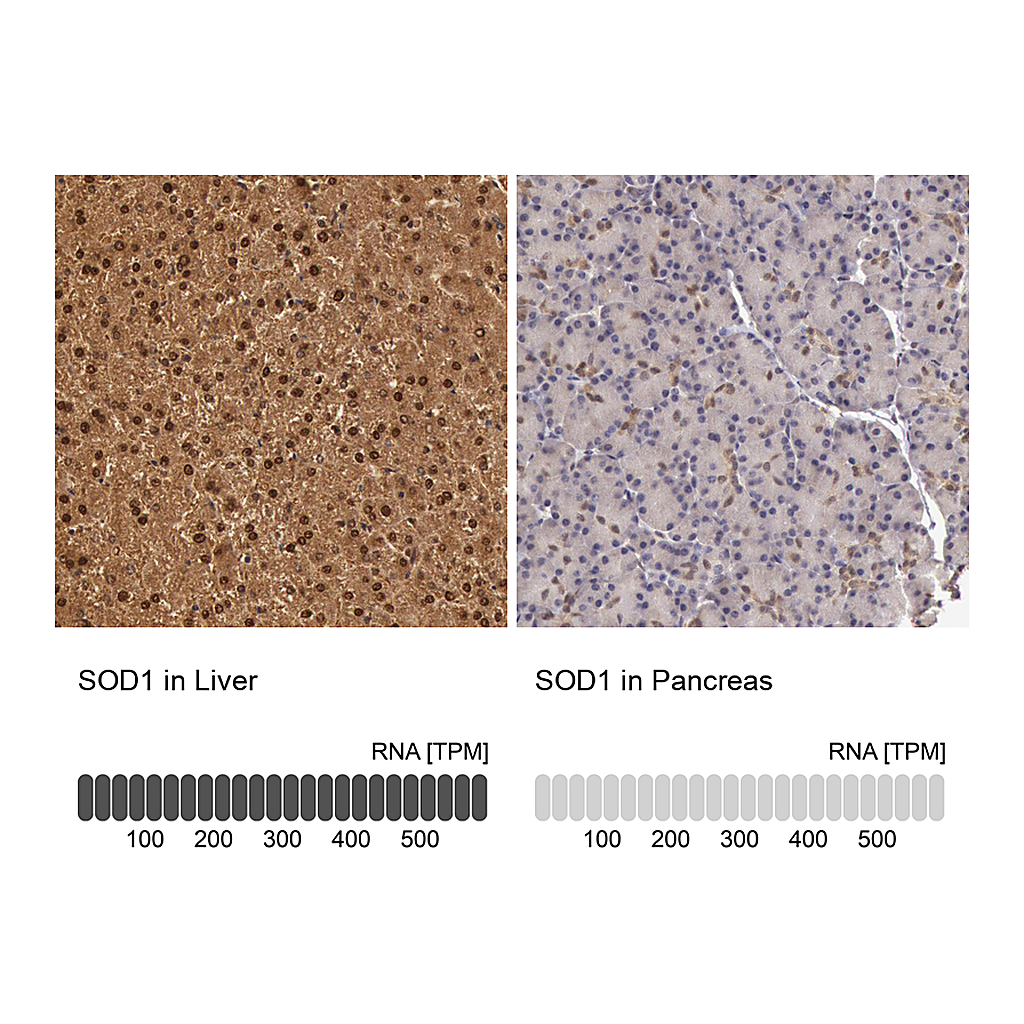 Atlas Antibodies Anti-SOD1 Antibody