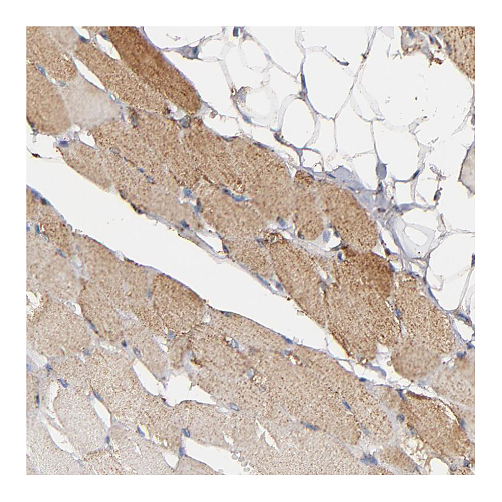 Atlas Antibodies Anti-SOD2 Antibody