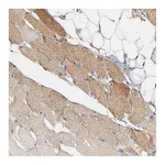 Atlas Antibodies Anti-SOD2 Antibody