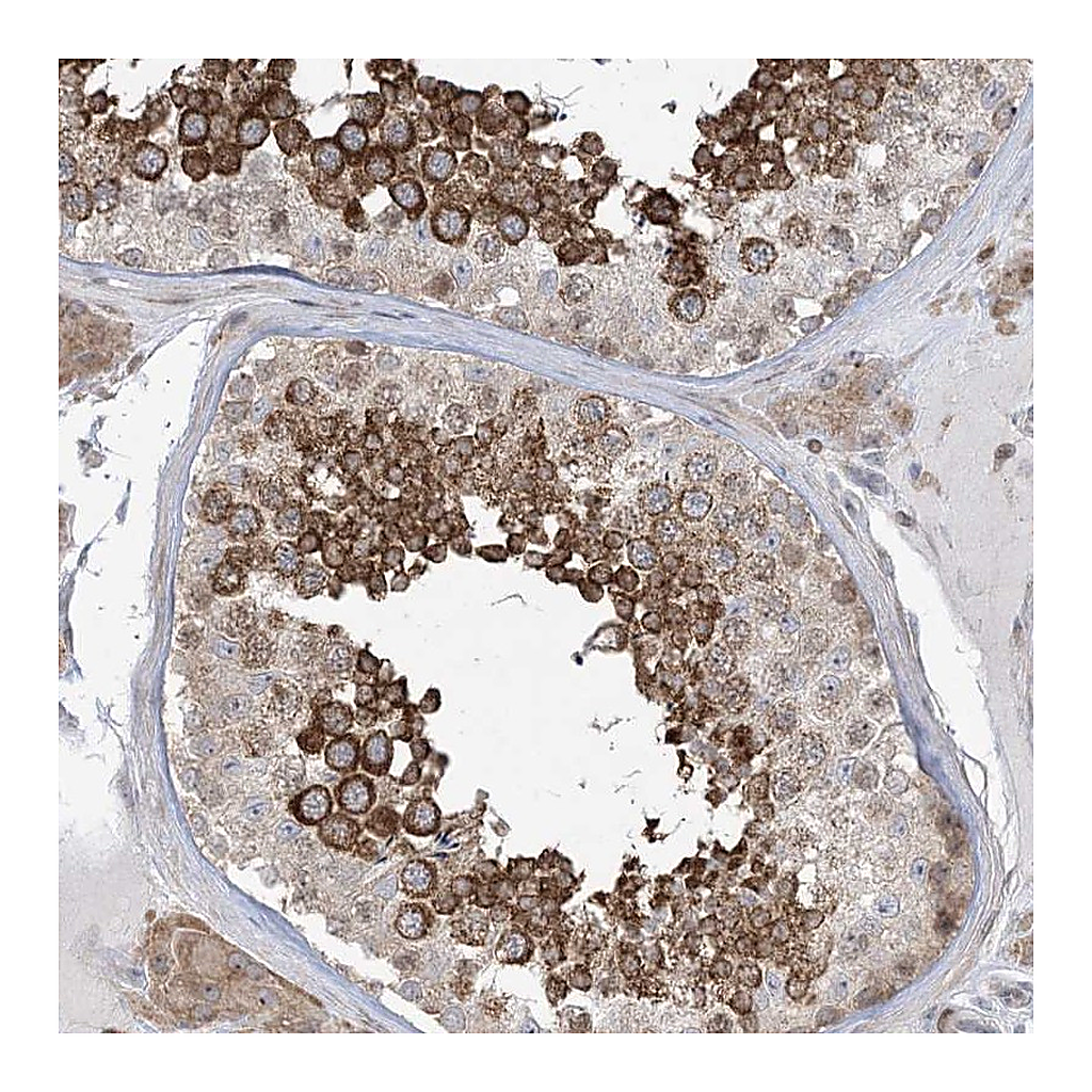 Atlas Antibodies Anti-SOGA3 Antibody