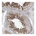 Atlas Antibodies Anti-SOGA3 Antibody