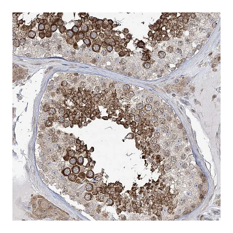 Atlas Antibodies Anti-SOGA3 Antibody