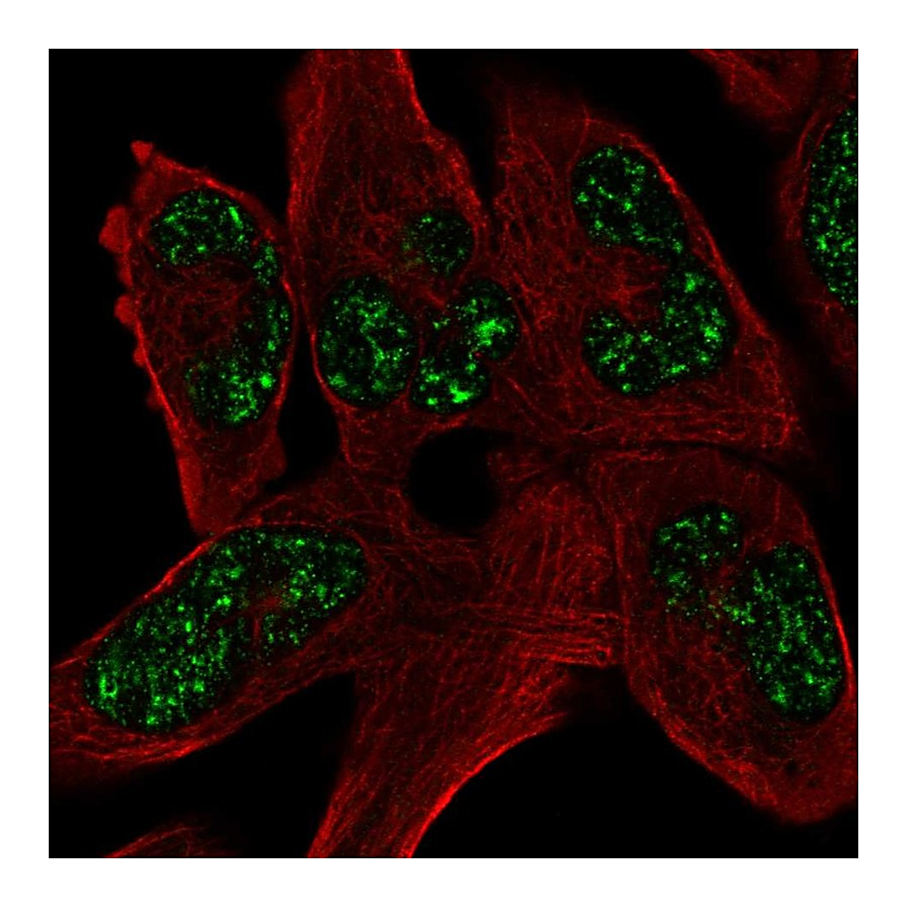 Atlas Antibodies Anti-SOHLH1 Antibody