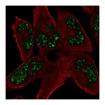 Atlas Antibodies Anti-SOHLH1 Antibody