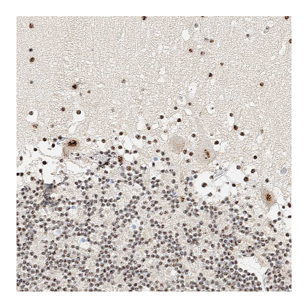 Atlas Antibodies Anti-SON Antibody