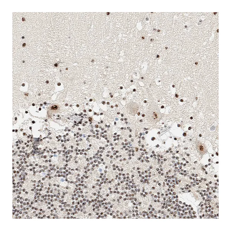 Atlas Antibodies Anti-SON Antibody