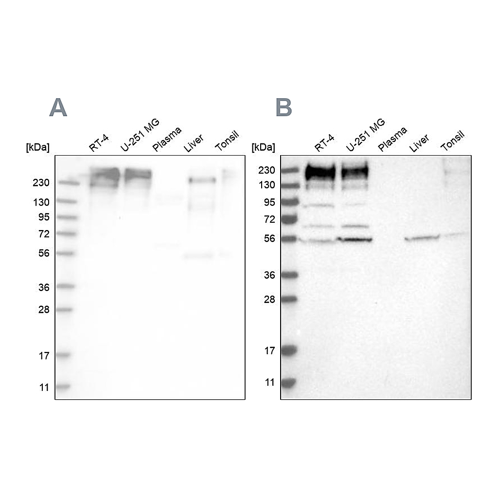 Atlas Antibodies Anti-SON Antibody