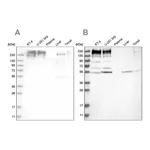 Atlas Antibodies Anti-SON Antibody