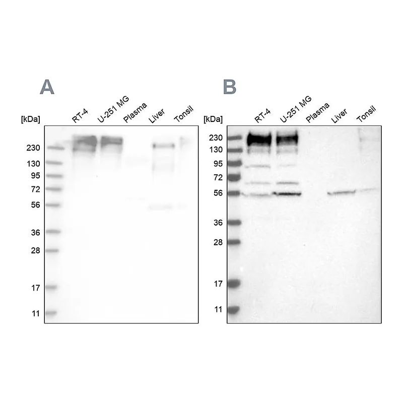 Atlas Antibodies Anti-SON Antibody