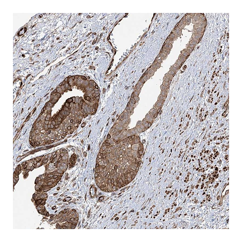Atlas Antibodies Anti-SOGA3 Antibody