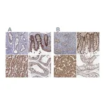 Atlas Antibodies Anti-SORBS1 Antibody