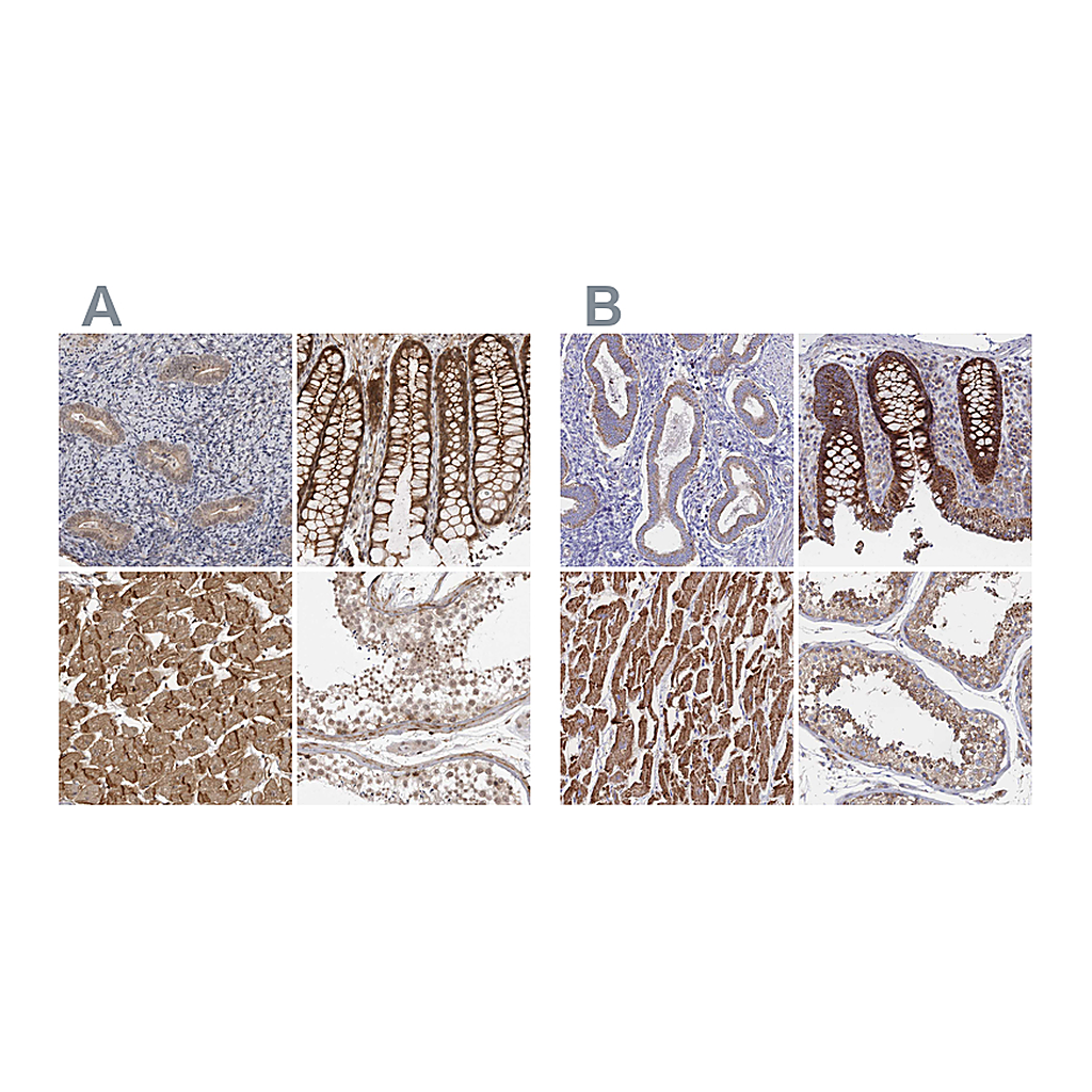 Atlas Antibodies Anti-SORBS1 Antibody