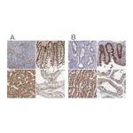 Atlas Antibodies Anti-SORBS1 Antibody