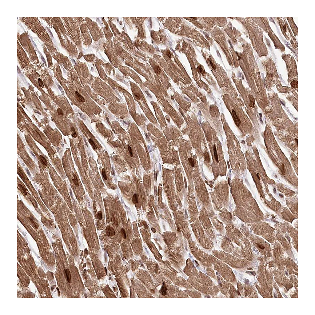Atlas Antibodies Anti-SORBS2 Antibody