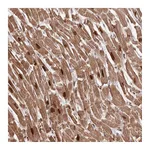 Atlas Antibodies Anti-SORBS2 Antibody