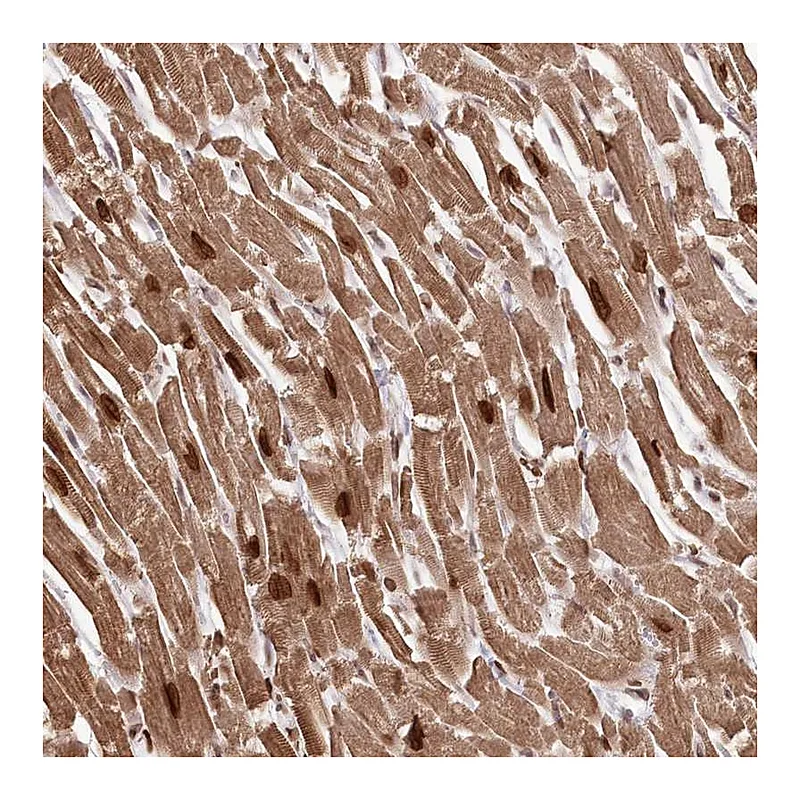 Atlas Antibodies Anti-SORBS2 Antibody