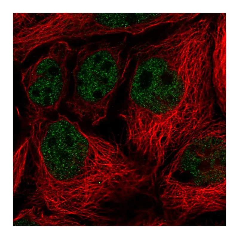 Atlas Antibodies Anti-SORBS3 Antibody