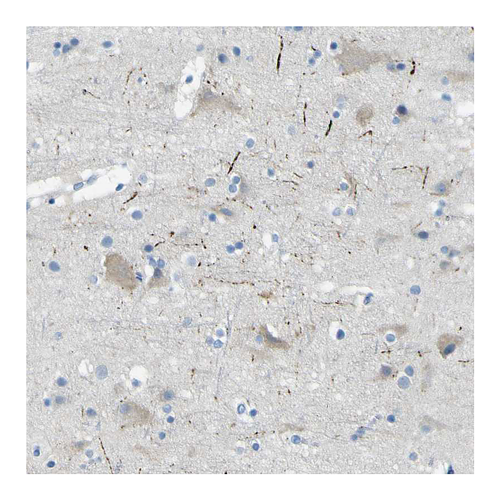 Atlas Antibodies Anti-SORCS1 Antibody