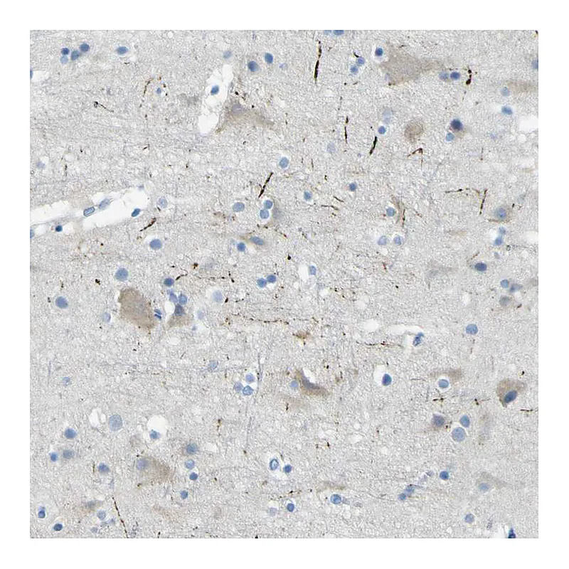 Atlas Antibodies Anti-SORCS1 Antibody