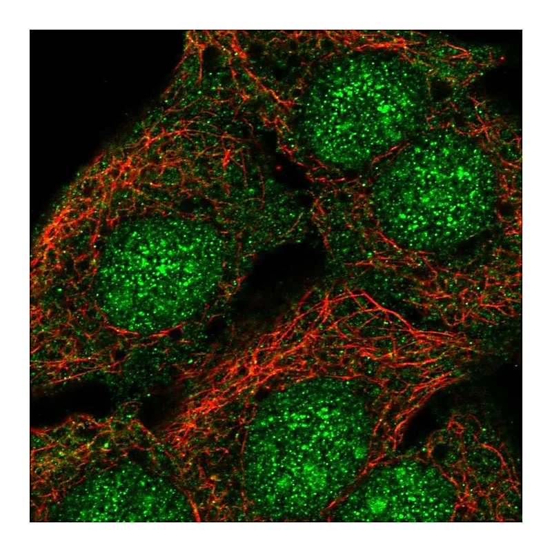 Atlas Antibodies Anti-SORCS2 Antibody